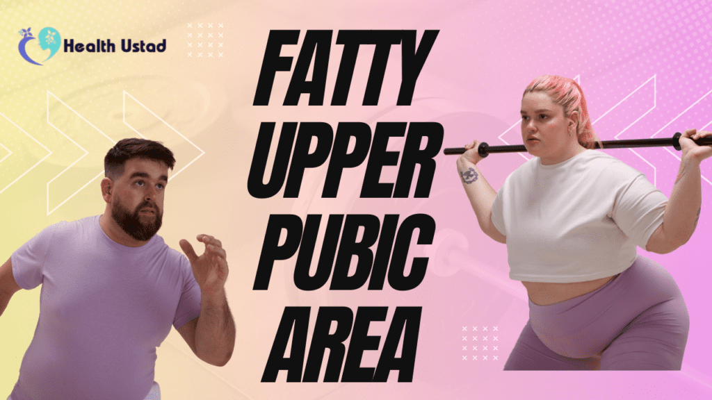 FUPA