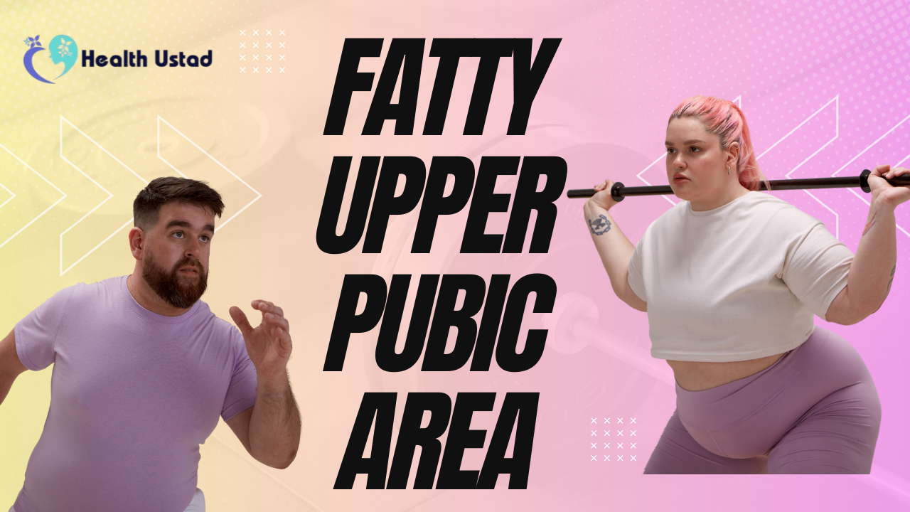 FUPA